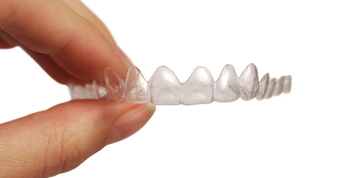 Invisalign